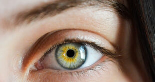 Optica Medicala